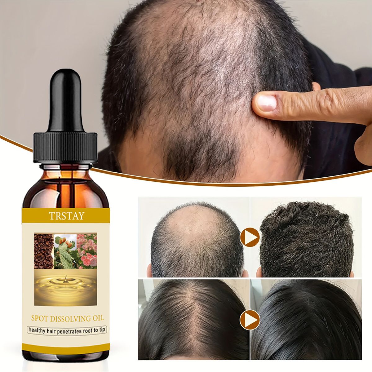 Beard Oil - 50ML aceite para el crecimiento de