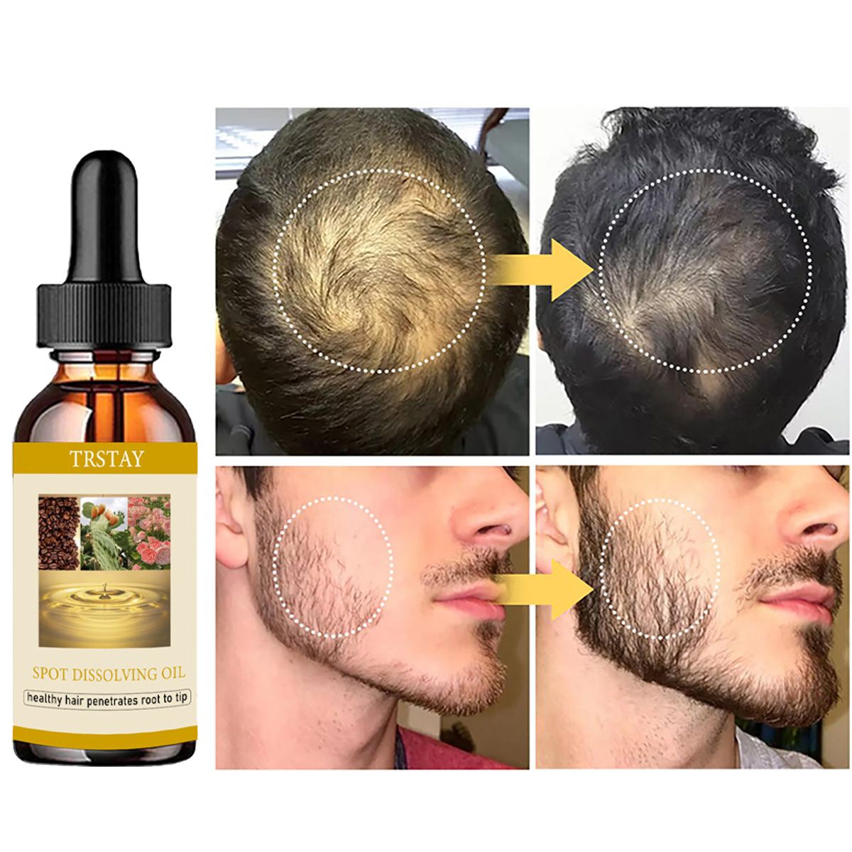 50ML aceite para el crecimient - Beard Oil reseña y precio